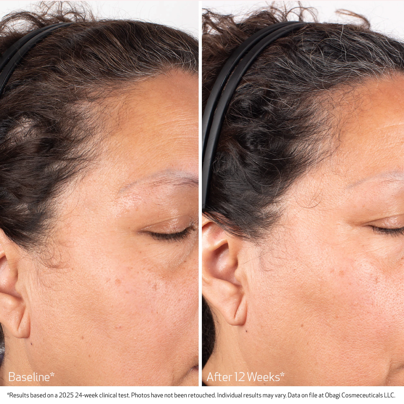 BioStim™ Scalp Serum