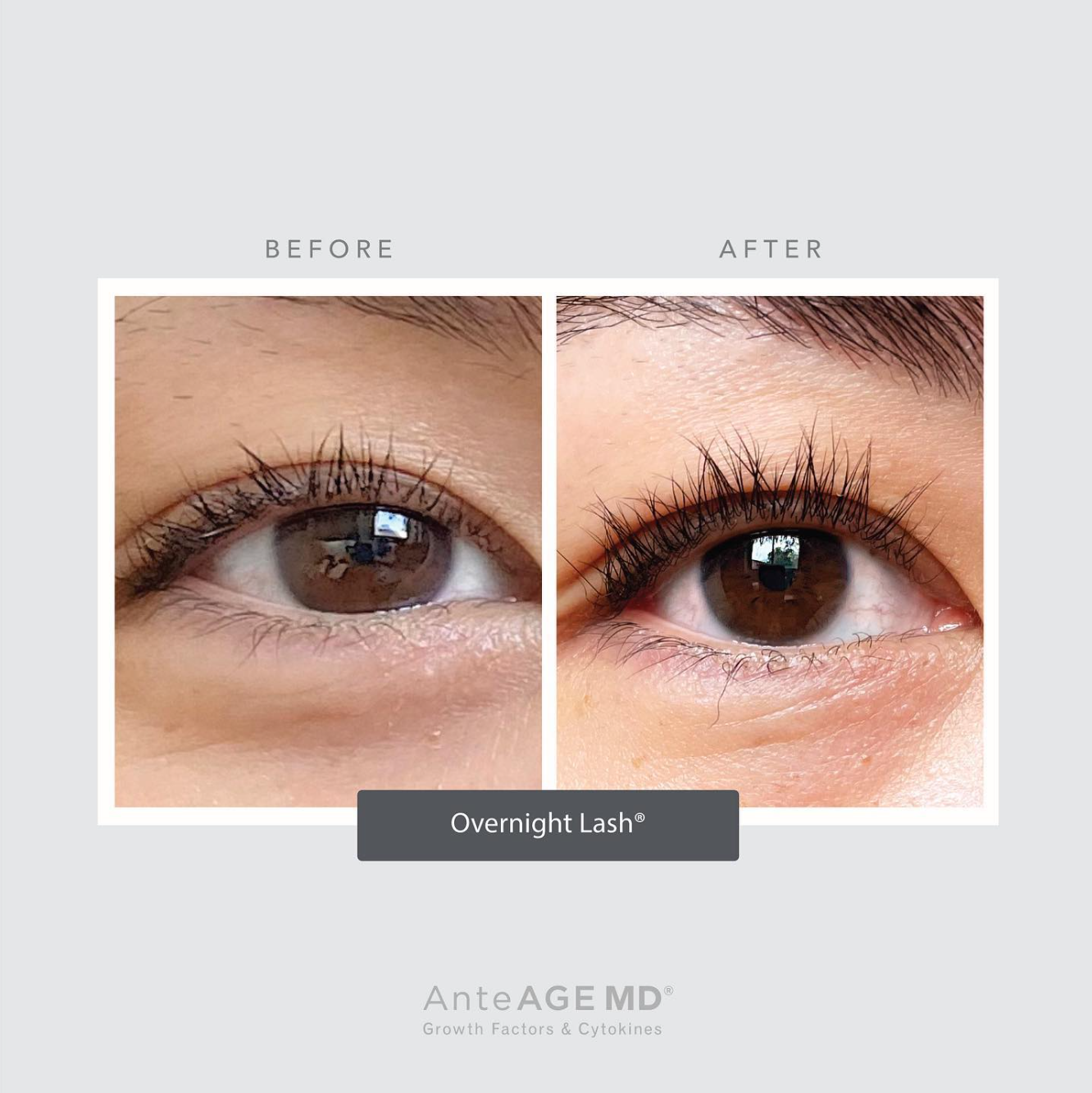 AnteAGE Lash Serum